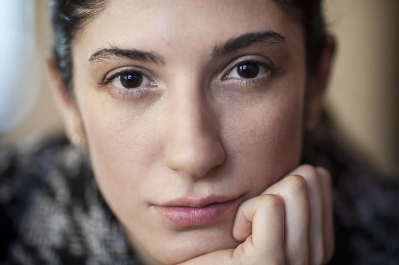 Alcanza el rejuvenecimiento facial sin cirugía